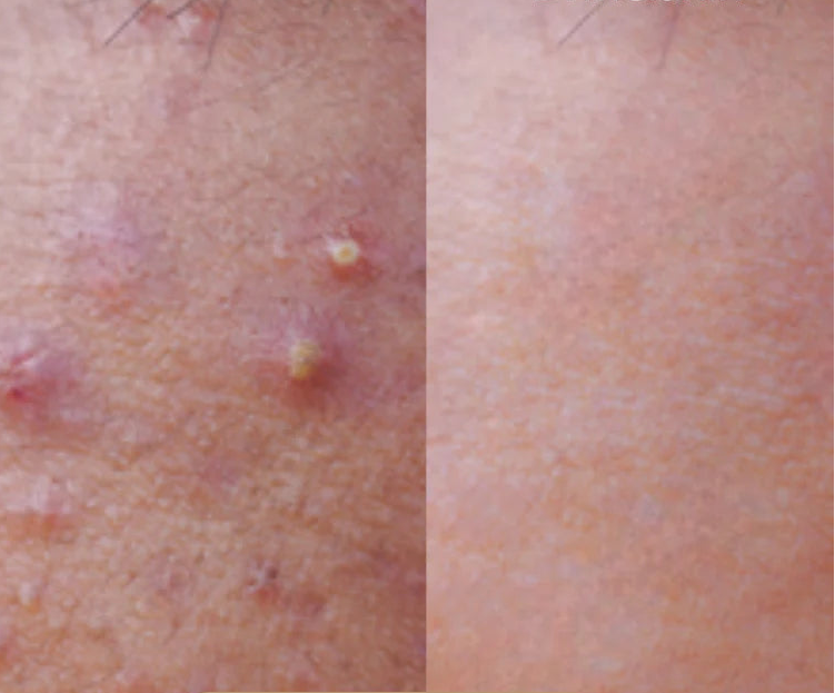 Exfoliant à base de riz-PureRice™