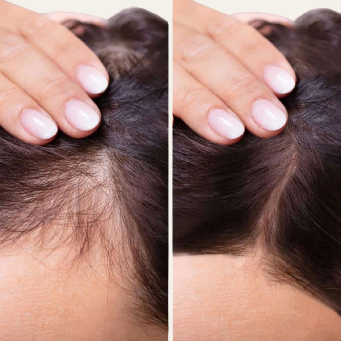 Sérum pousse de cheveux- Élixir de Romarin™