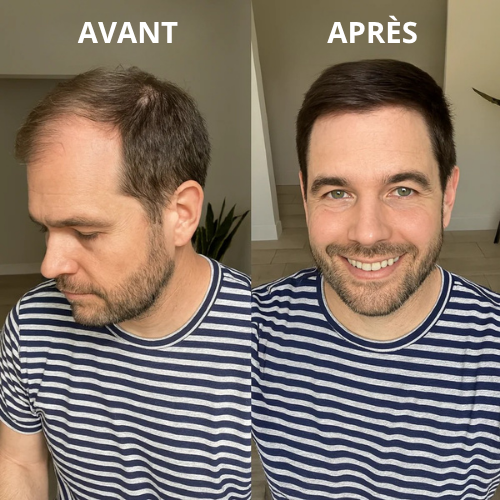 Sérum pousse de cheveux- Élixir de Romarin™