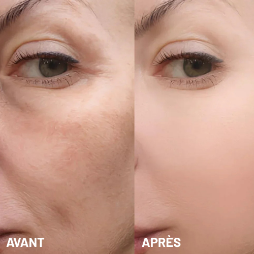 Exfoliant à base de riz-PureRice™